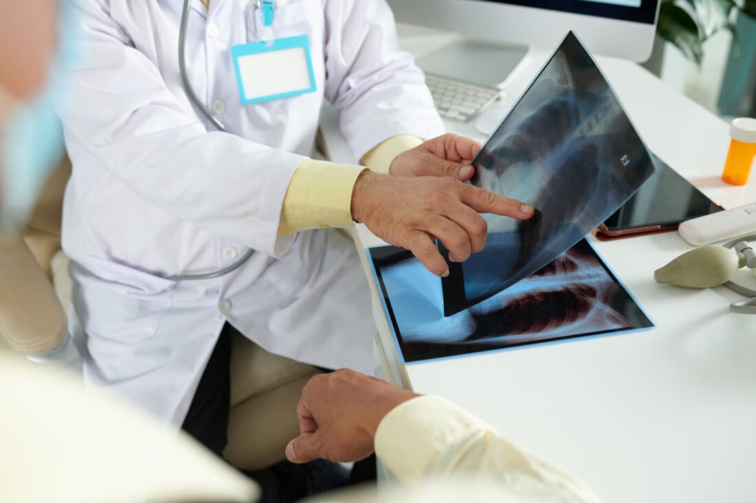 Doctor pointing at patient's X rays